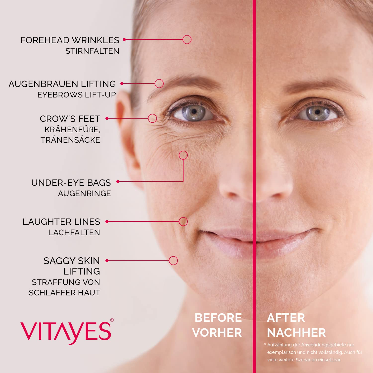 VITAYES Anti Aging Skin Care and Face Cream Moisturizer For Men and Women Instant Anti Wrinkle Day and Night Cream - Reduce Fine Lines and Age Spots in just 5 Minutes!